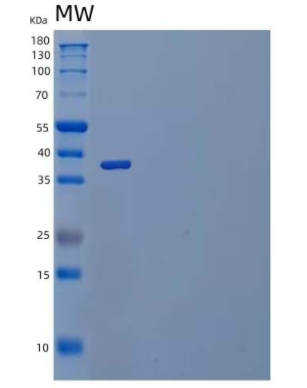 Recombinant Human IL-23 Recetor/IL-23R Protein(C-6His)