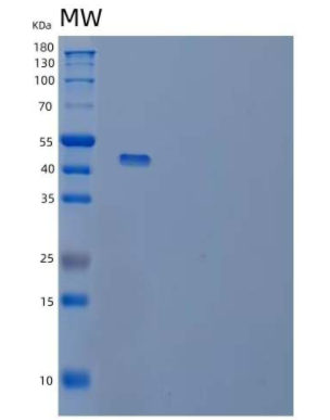 Recombinant Human Tumor Necrosis Factor Receptor I/TNFRSF1A/CD120a Protein(C-Fc)