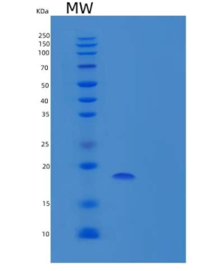 Recombinant Human Peroxiredoxin-5/PRDX5 Protein(N-6His)