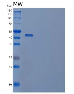 Recombinant Human Izumo sperm-egg fusion protein 4 Protein