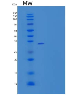 Recombinant Human Deoxycytidine Kinase/DCK Protein(N-6His, T7 tag)