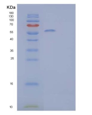 Recombinant Human α-Amylase 2B/AMY2B Protein(C-6His)