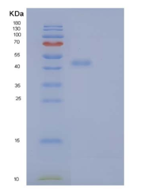 Recombinant Human ER Resident Protein 44/ERp44/TXNDC4 Protein(C-6His)