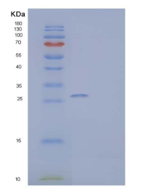 Recombinant Human Bisphosphoglycerate Mutase/BPGM Protein(C-6His)