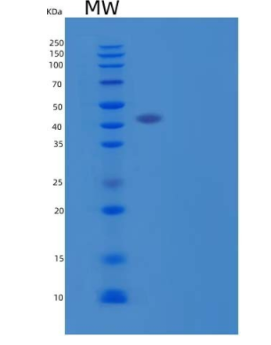 Recombinant Human Leukocyte Mono Ig-Like Receptor 1/LMIR1/CD300a Protein(C-Fc-6His)