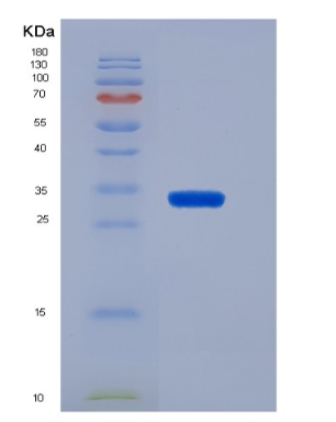 Recombinant Human CD19 / Leu-12 Protein (His tag)