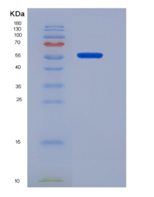 Recombinant Human CD19 Protein(C-Fc)