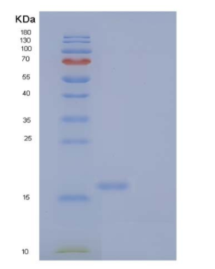 Recombinant Human NKG2-D type II Integral Membrane Protein