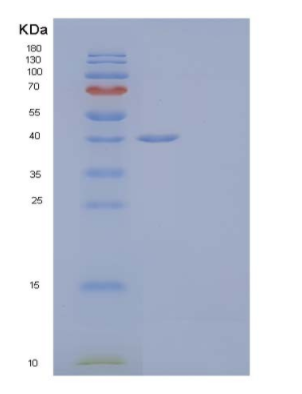 Recombinant Human Fructose-Bisphosphate Aldolase C/ALDOC Protein(C-6His)