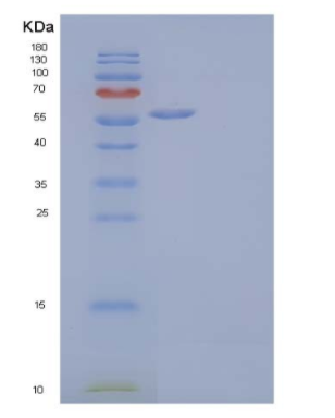 Recombinant Human MHC Class I Polypeptide-Related Sequence A/MICA Protein(C-Fc)