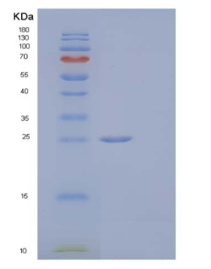 Recombinant Human Serpin B5/SERPINB5/Maspin Protein