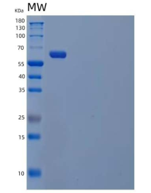 Recombinant Human Sialic Acid-Binding Ig-Like Lectin 9/Siglec 9/CD329 Protein(C-Fc)