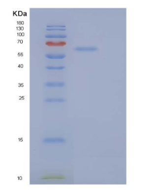 Recombinant Human Secretogranin-2/SCG2 Protein(C-6His)