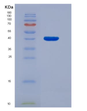 Eukaryotic T-Cell Surface Glycoprotein CD3 Epsilon (CD3e)