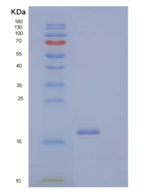 Recombinant Human CD40 Ligand/CD40L/TNFSF5 Protein