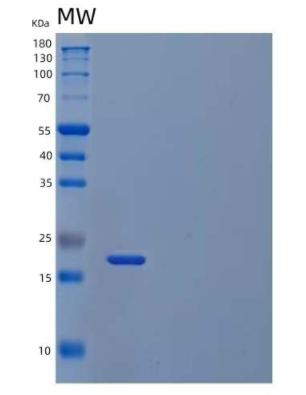 Recombinant Human SOD2/Mn-SOD Protein(C-6His, Cells)