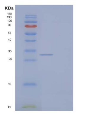 Recombinant Mouse Butyrophilin Subfamily 1 Member A1/BTN1A1 Protein(C-6His)