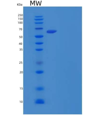 Recombinant Mouse Cell adhesion molecule 1 Protein