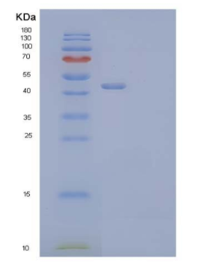 Recombinant Mouse Clusterin Protein