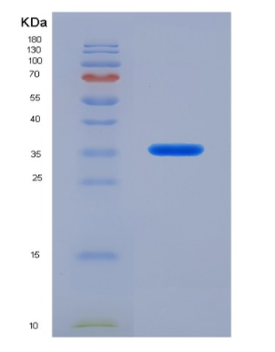 Recombinant Interleukin 21 (IL21)