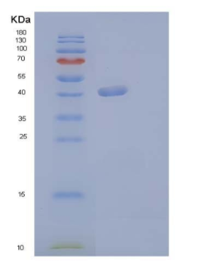 Recombinant Human G-CSF / CSF3 Protein (Fc tag)