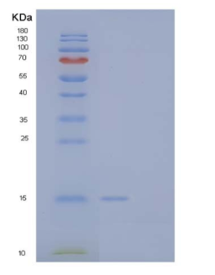 Recombinant Human Microtubule-Associated Protein 1 Light Chain 3 α/MAP1LC3A Protein(C-6His)