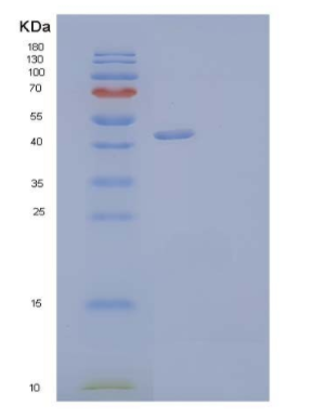 Recombinant Human Netrin-G1/NTNG1 Protein(C-6His)