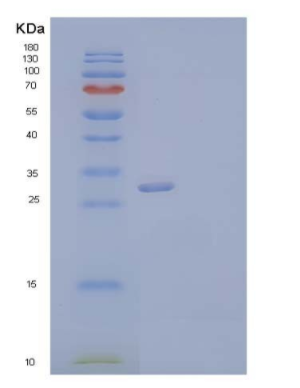 Recombinant Human Neurexophilin-1/NXPH1 Protein(C-6His)