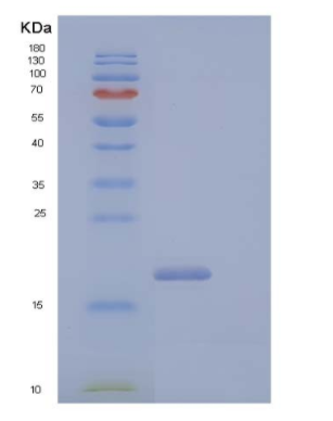 Recombinant Human CD99 Antigen-Like Protein 2/CD99L2 Protein(C-6His)