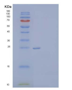 Recombinant Human Neuronal Acetylcholine Receptor Subunit β-3/CHRNB3 Protein(C-6His)