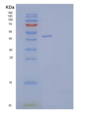 Recombinant Human Testin/TES Protein(C-6His)