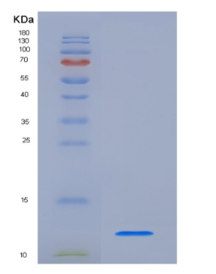 Eukaryotic Chemokine (C-X-C Motif) Ligand 1 (CXCL1)