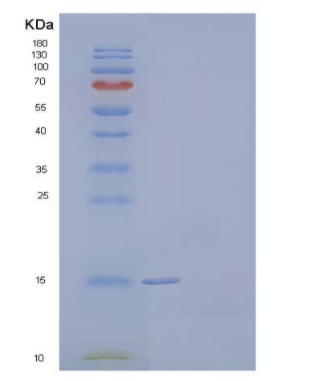 Recombinant Human Hemoglobin Subunit α/HBA1 Protein(N-6His)