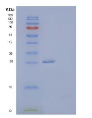 Recombinant Human Coagulation Factor III/Tissue Factor/CD142 Protein(C-6His)