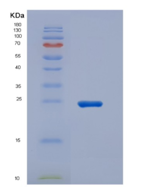 Recombinant High Mobility Group Protein 1 (HMGB1)