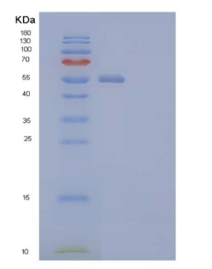 Recombinant Human Host Cell Factor 2/HCFC2 Protein(N-6His)