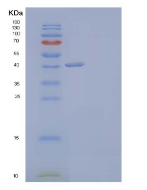 Recombinant Human THSD1/TMTSP Protein(C-6His)