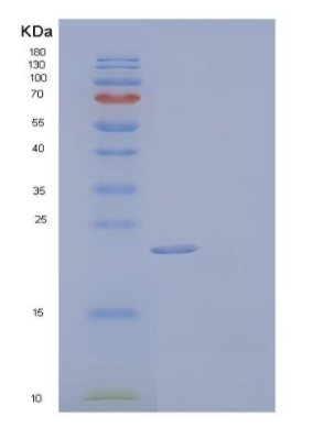 Recombinant Human Complement Component C8 γ Chain/C8G Protein(N-6His)