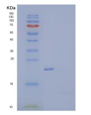 Recombinant Human Thymopoietin/TMPO/LAP2 Protein(C-6His)