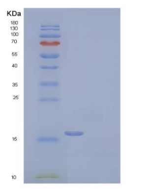 Recombinant Human Connective Tissue Growth Factor/CTGF/CCN2 Protein