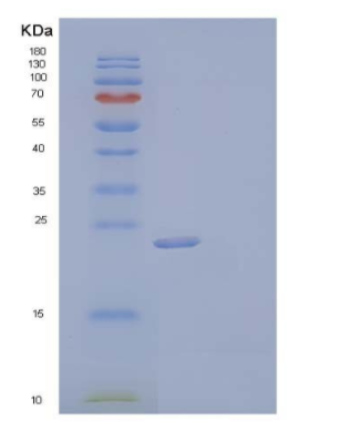 Recombinant Mouse Fibroblast Growth Factor 9/FGF-9Protein(C-6His)