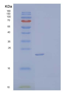 Recombinant Human Tissue Inhibitor of Metalloproteinases 2/TIMP-2 Protein(C-6His)