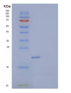 Recombinant Mouse Fms-LikeTyrosine Kinase 3 Ligand/FLT3LG Protein(C-6His)