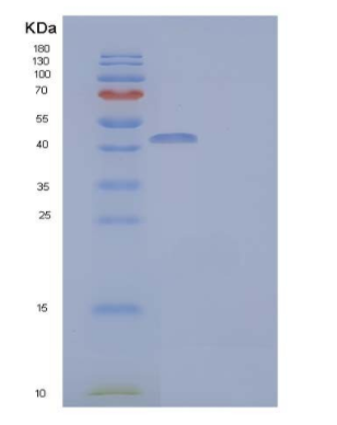 Recombinant Human IL-15 Receptor α & IL-15 Fusion Protein/IL15RA&IL15 Protein(C-Fc)
