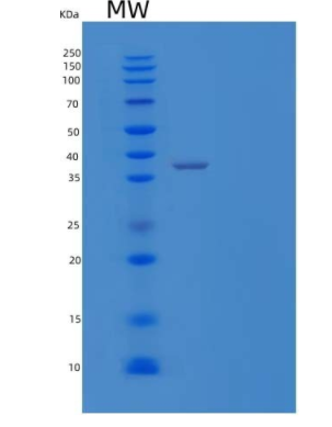 Recombinant Human IL-1 Receptor-Like 2/IL-1RL2 Protein(C-6His)