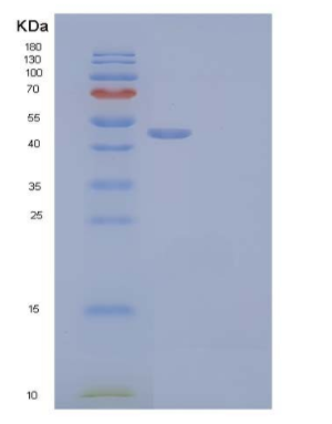 Recombinant Human Ornithine Decarboxylase/ODC1 Protein(C-6His, N-T7 tag)