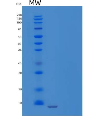 Recombinant Human Parathyroid Hormone/Parathormone/PTH(1-84) Protein