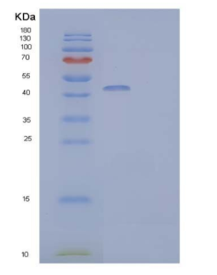 Recombinant Human IL-22 Receptor Subunit α2/IL-22BP/IL-22RA2 Protein(C-Fc)