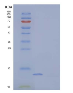 Recombinant Human Parvalbumin ?±/PVALB Protein(C-6His)