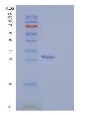 Recombinant Mouse Insulin-like Growth Factor-Binding Protein 5/IGFBP5 Protein(C-6His)